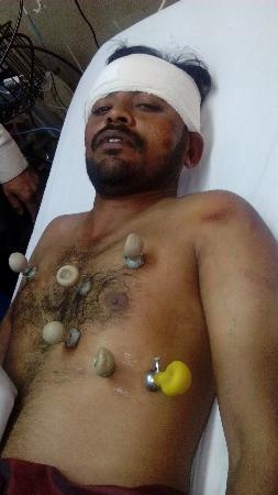 Album4: MQM Worker Fahad Aziz Tortured By Karachi Police 